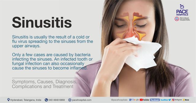 Sinus pressure on one store side of face